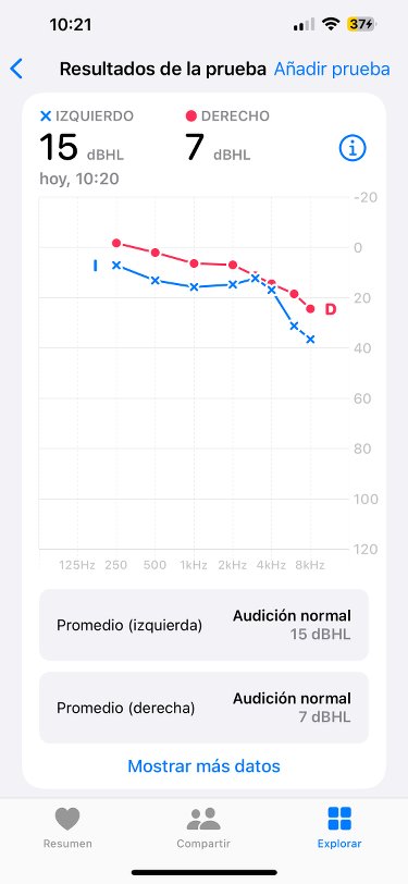 Resultados del test del oído Resultados del test del oído
